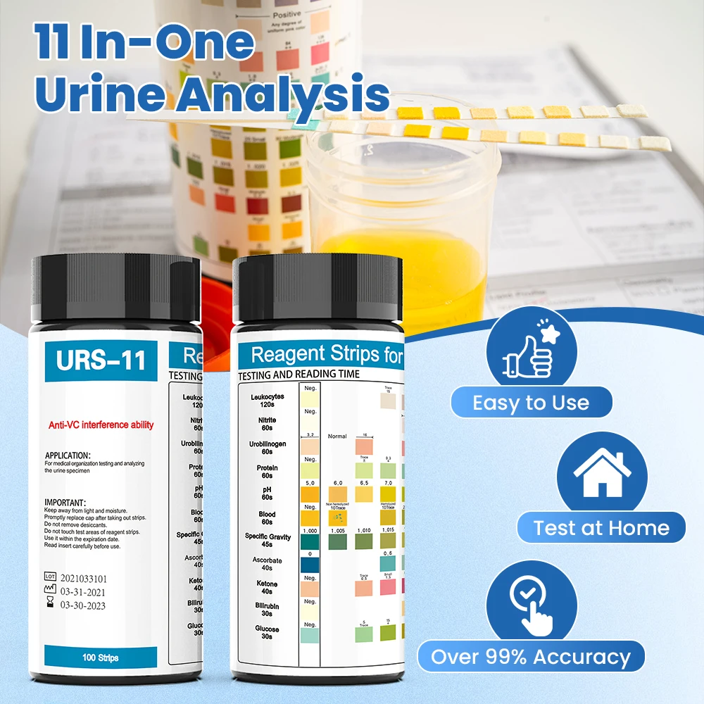 شرائط اختبار محلل البول البيطر - مراجعة Urinalysis Reagent Strip وسعره